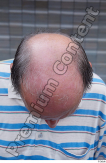 Street  654 bald hair head 0003.jpg